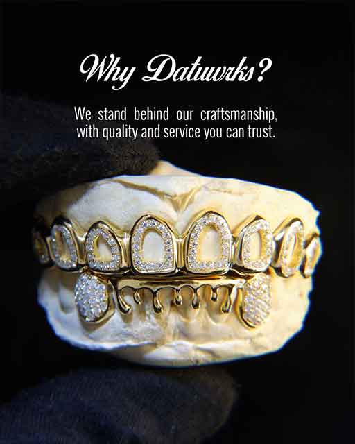 Custom grillz showcase 1 - crafted by expert jewelers