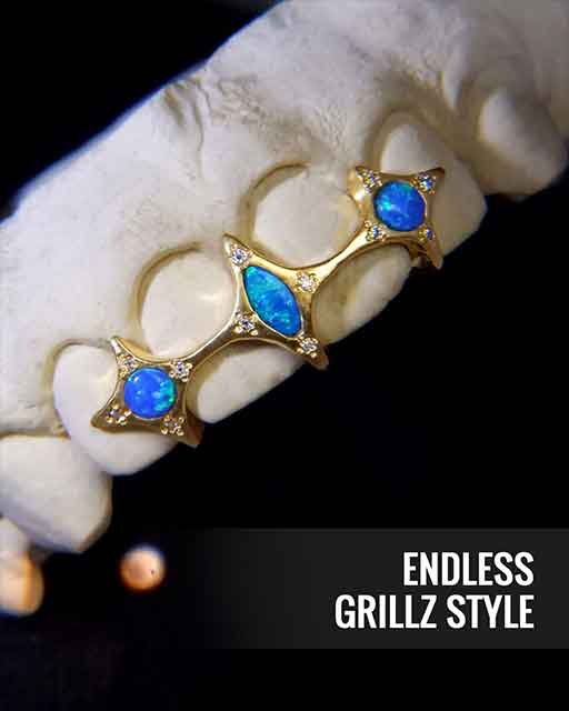 Custom grillz showcase 3 - crafted by expert jewelers