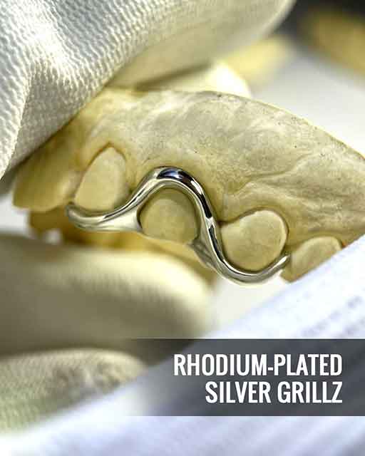 Custom grillz showcase 6 - crafted by expert jewelers