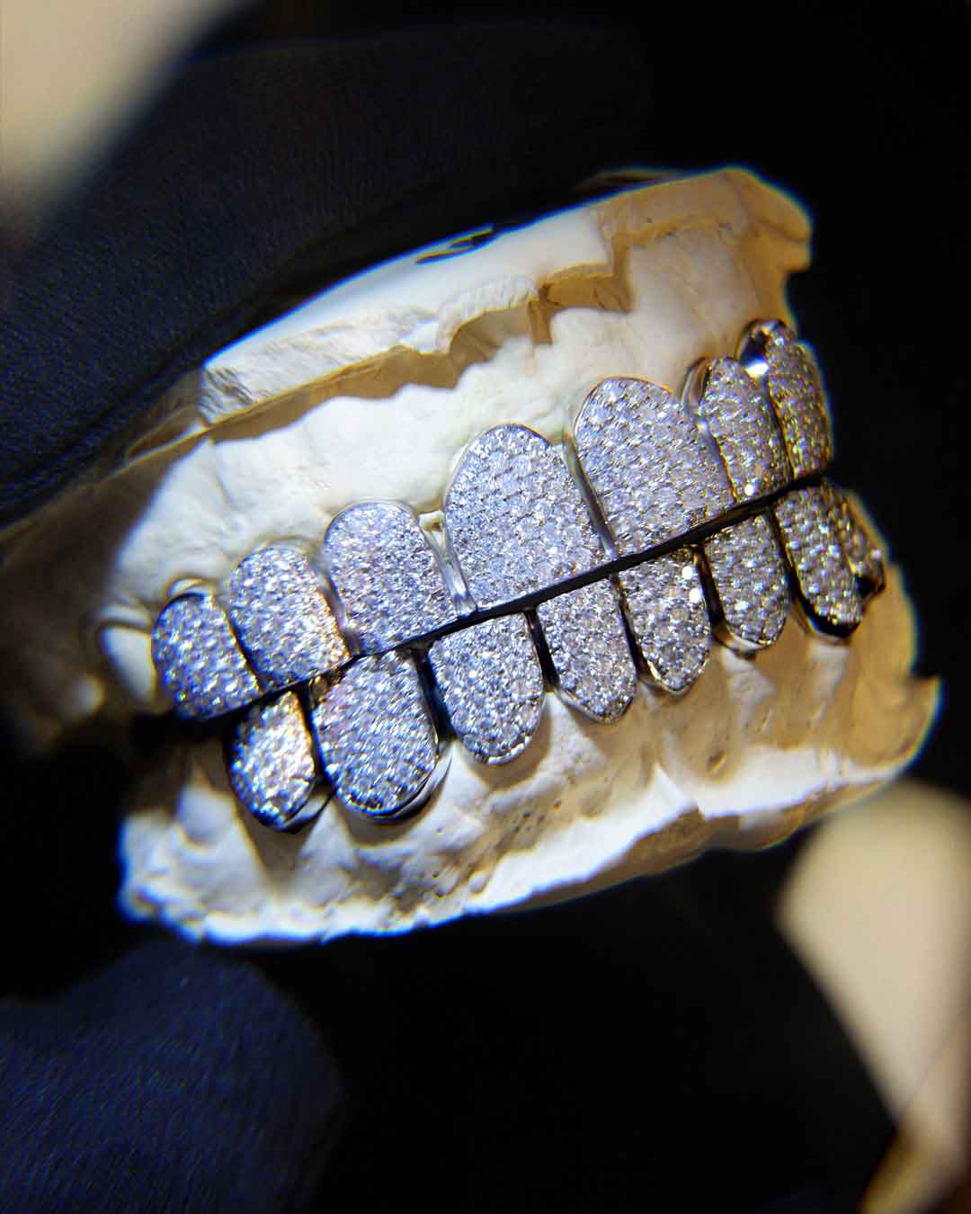 Iced-Out Grillz - Fully set with stones, maximum shine - DATUWRKS custom grillz