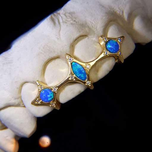 DATUWRKS custom gold and silver grillz gallery 23 - handcrafted grillz Bali