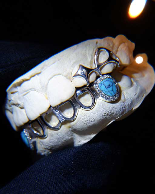 DATUWRKS custom gold and silver grillz gallery 25 - handcrafted grillz Bali