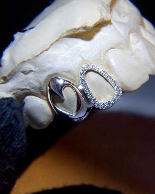 DATUWRKS custom grillz gallery showcase 1