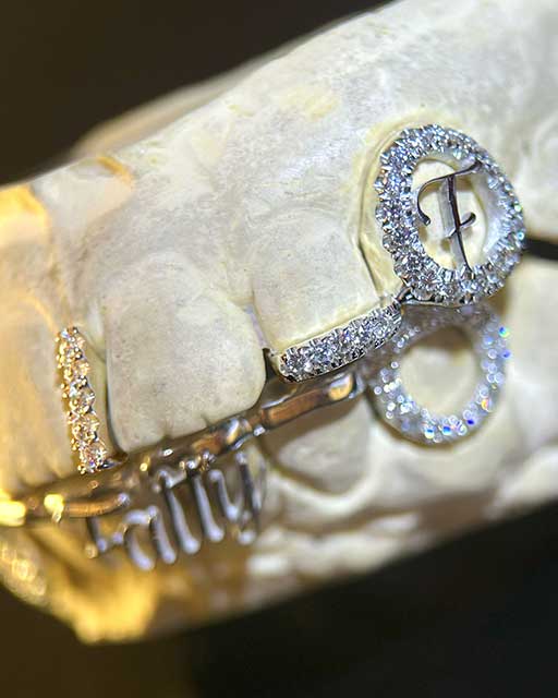 DATUWRKS custom grillz gallery showcase 23