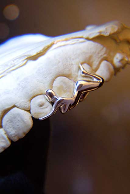 DATUWRKS custom grillz gallery showcase 11