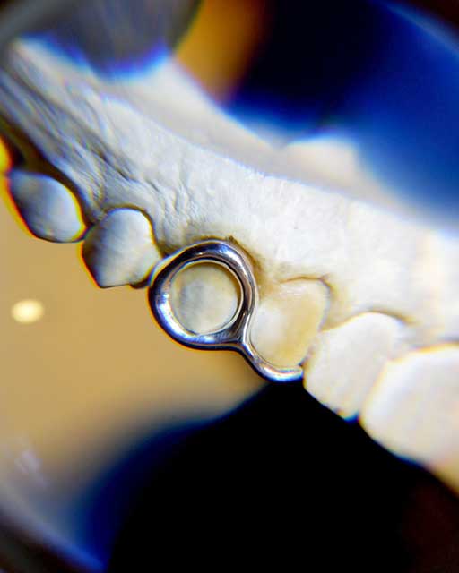 DATUWRKS custom grillz gallery showcase 14