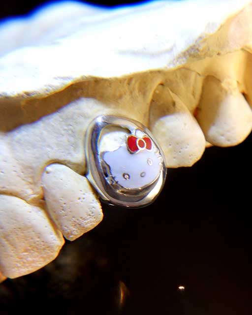 DATUWRKS custom grillz gallery showcase 18