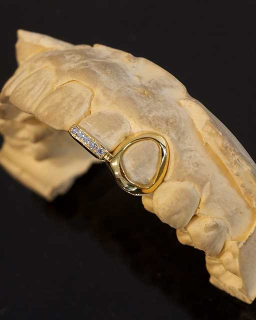 DATUWRKS custom grillz gallery showcase 26