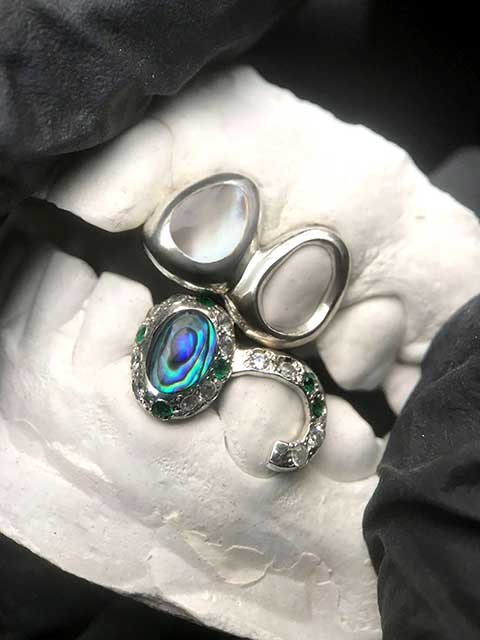 DATUWRKS custom grillz gallery showcase 3