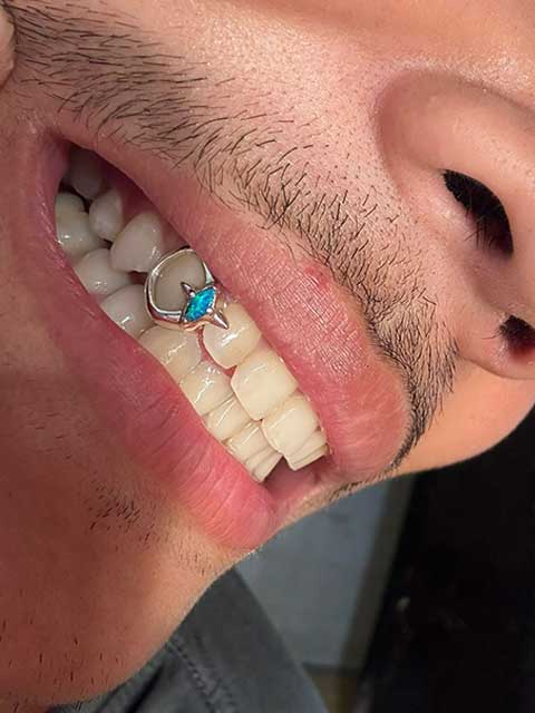 DATUWRKS custom gold and silver grillz gallery 28 - handcrafted grillz Bali