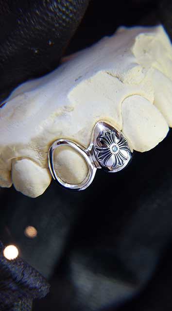 DATUWRKS custom grillz gallery showcase 10