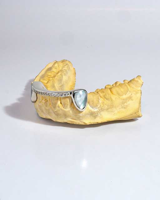 DATUWRKS custom grillz gallery showcase 20