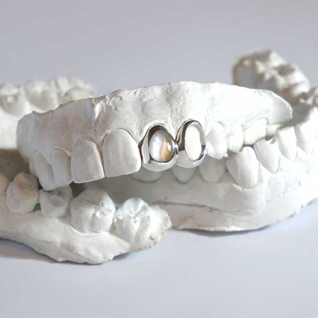 DATUWRKS custom grillz gallery showcase 5