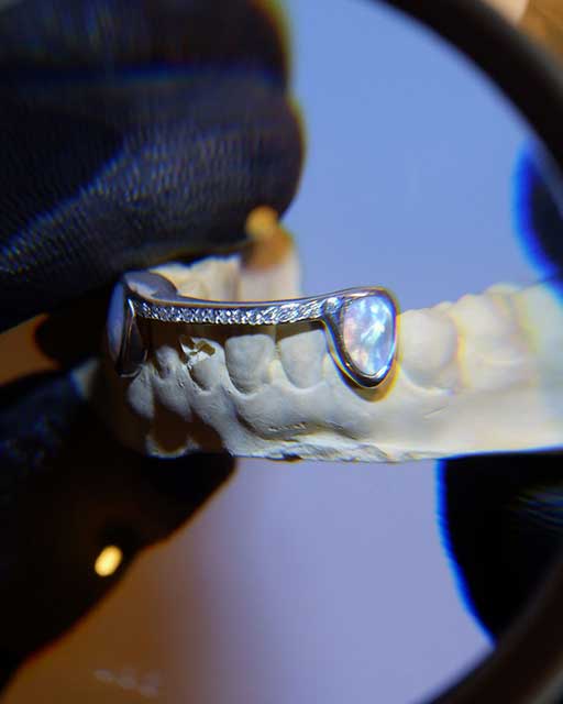 DATUWRKS custom grillz gallery showcase 25