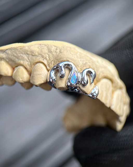 DATUWRKS custom grillz gallery showcase 2