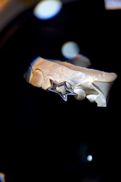 DATUWRKS custom gold and silver grillz gallery 4 - handcrafted grillz Bali