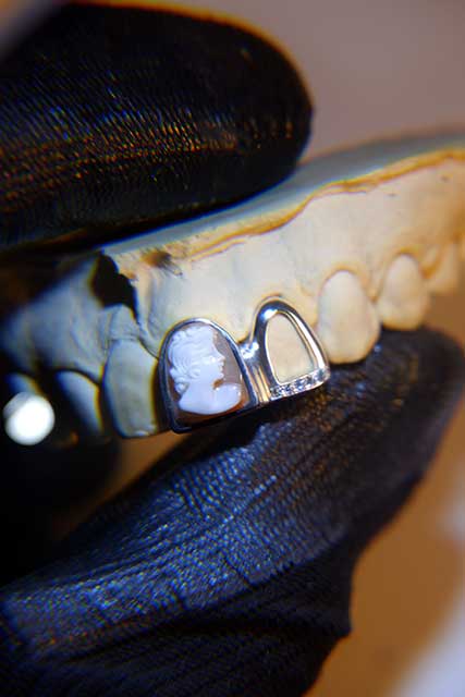 DATUWRKS custom gold and silver grillz gallery 9 - handcrafted grillz Bali